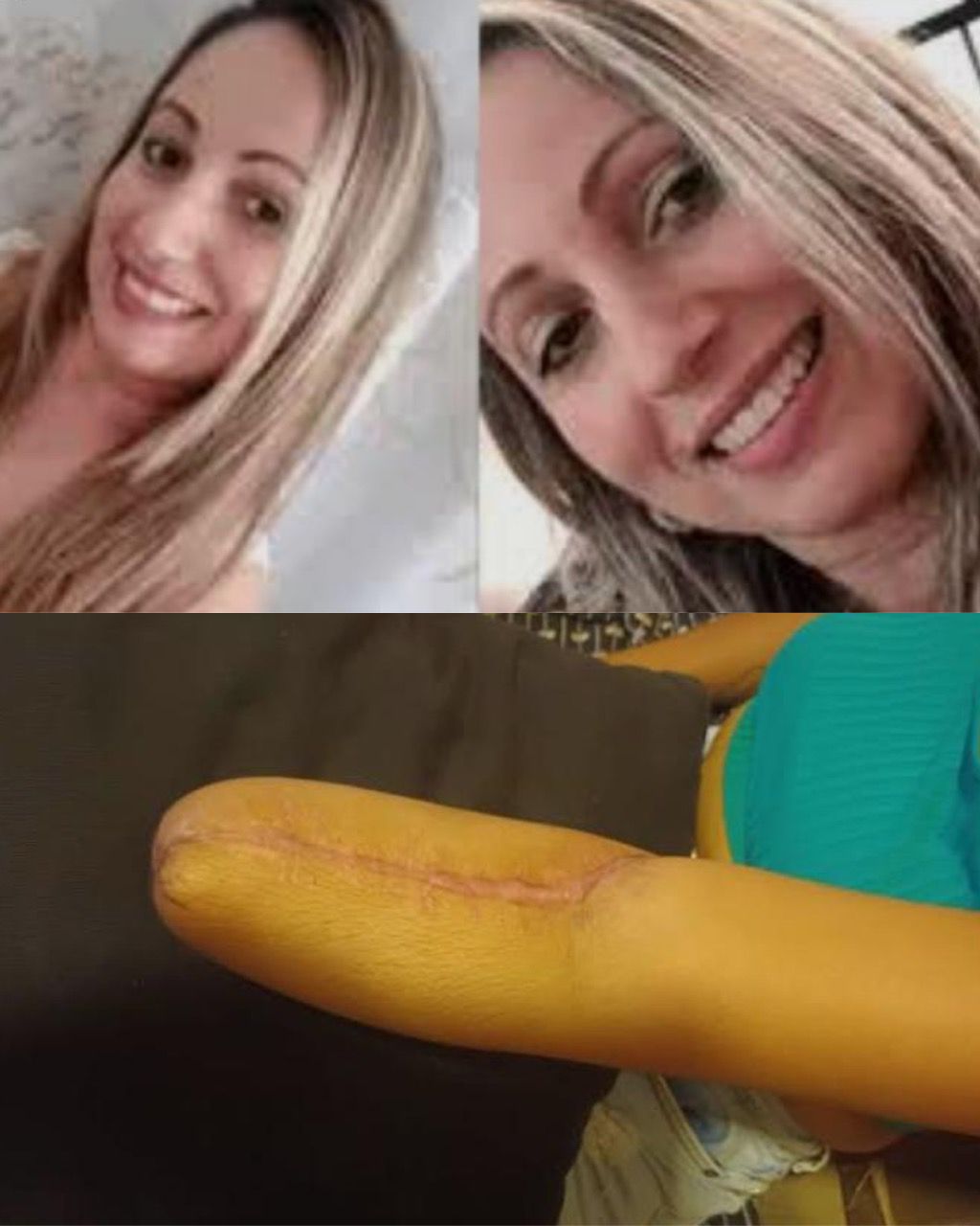 Profesora resulta herida durante un ataque a una escuela en Suzano